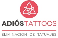 franquicia Adiós Tattoos  (Eliminación de marcas en la piel)
