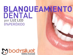 Blanqueamiento dental en Bodysiluet