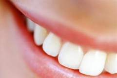 Cita entre fresissima® y Willi Geller para hablar sobre el futuro en el sector dental. 